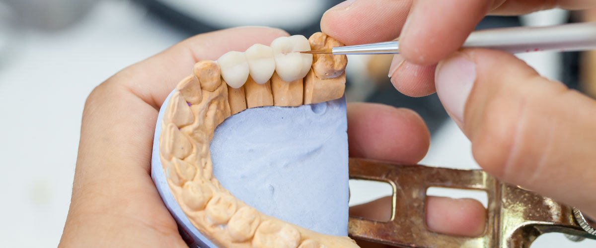 Bellingham Dental Lab