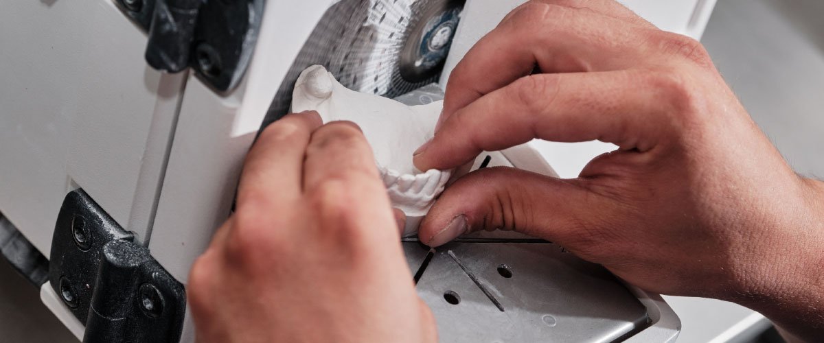 Bellingham Dental Lab