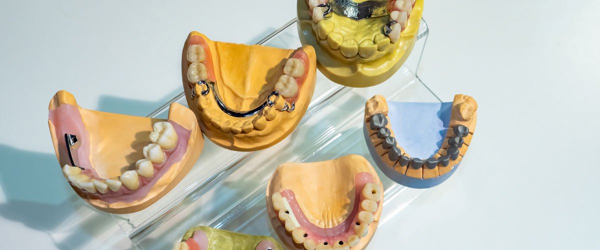 Bellingham Dental Lab