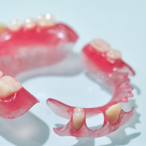 Flexible Partial Dentures