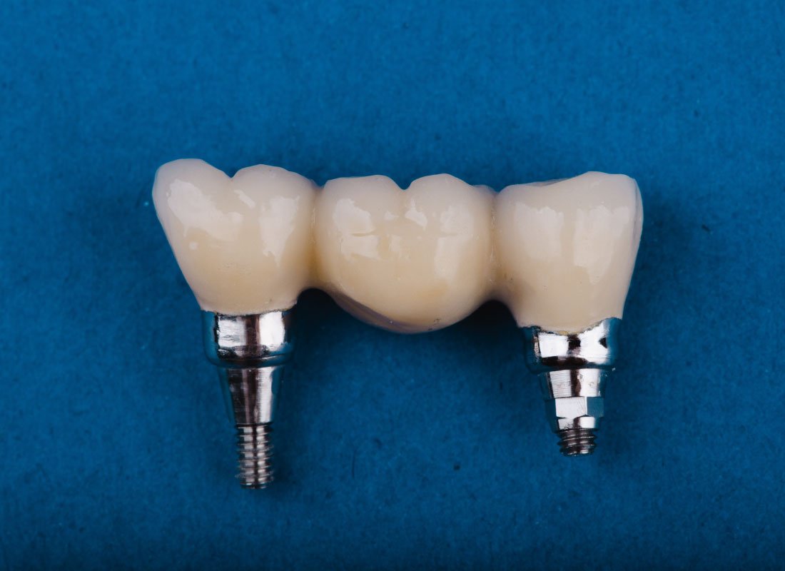 Bellingham Dental Laboratory