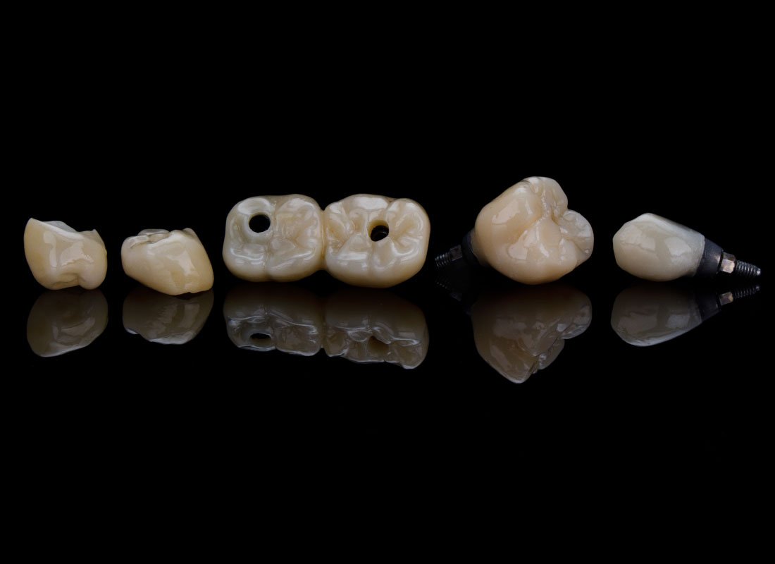 Bellingham Dental Laboratory