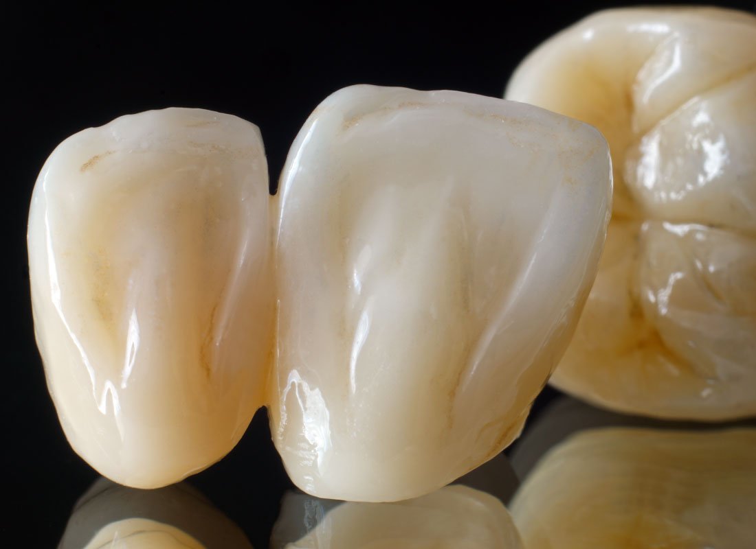 Bellingham Dental Laboratory