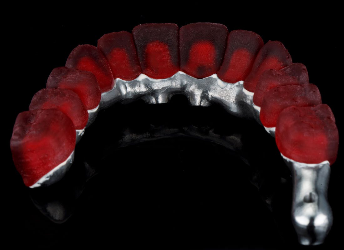 Bellingham Dental Laboratory