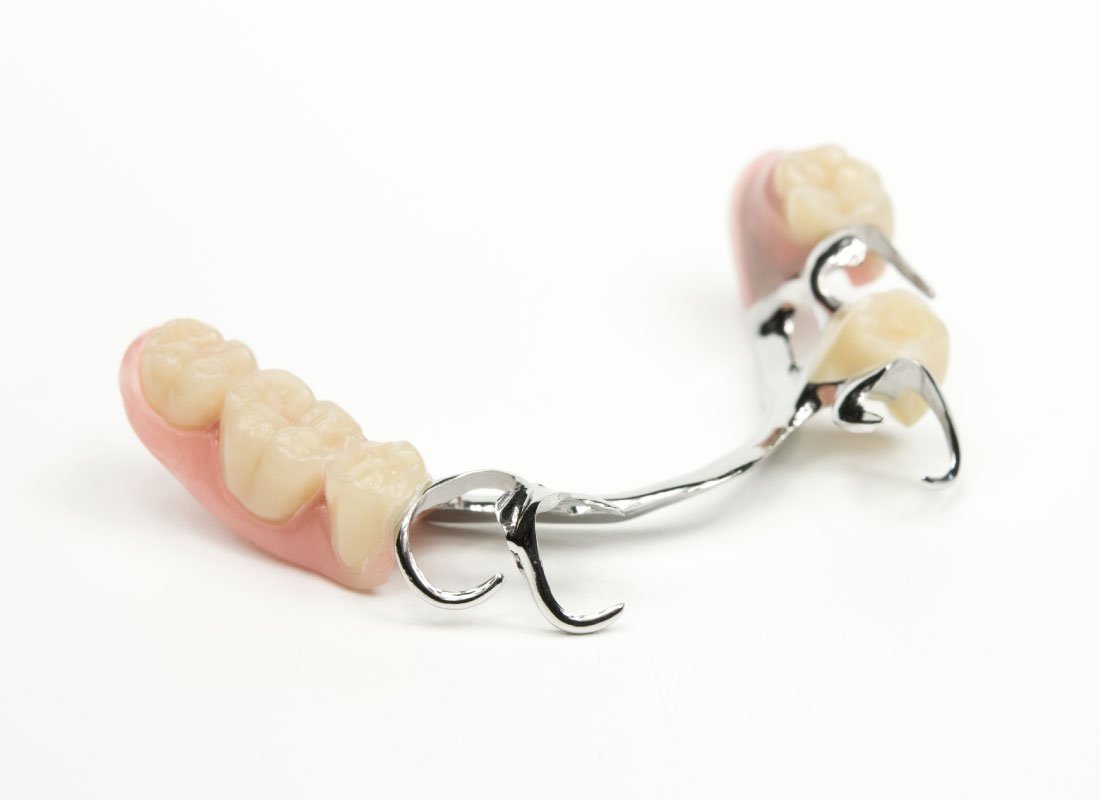 Bellingham Dental Laboratory