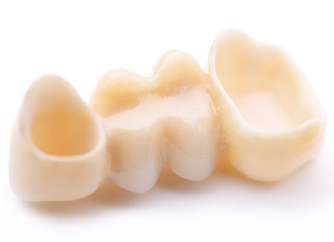 Bellingham Dental Laboratory