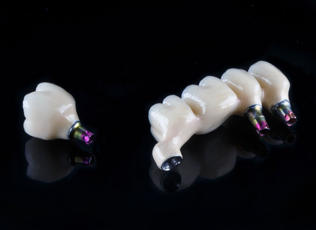 Bellingham Dental Laboratory