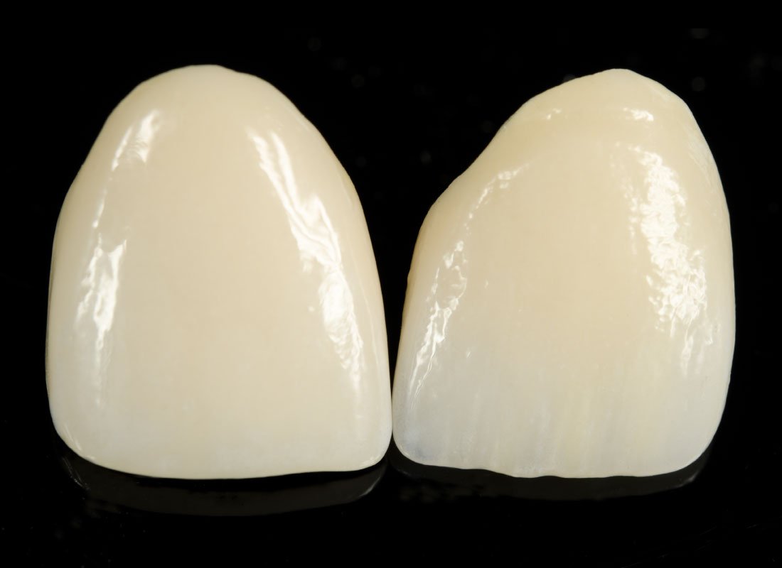 Bellingham Dental Laboratory