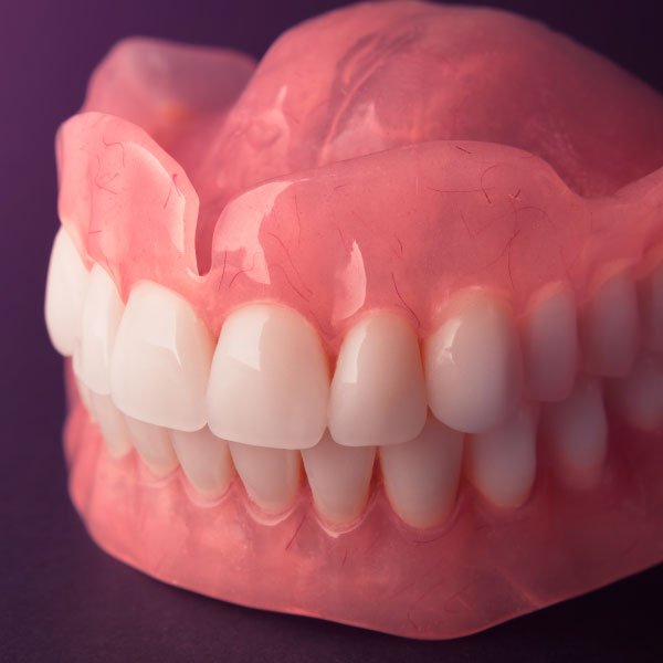 Immediate Dentures