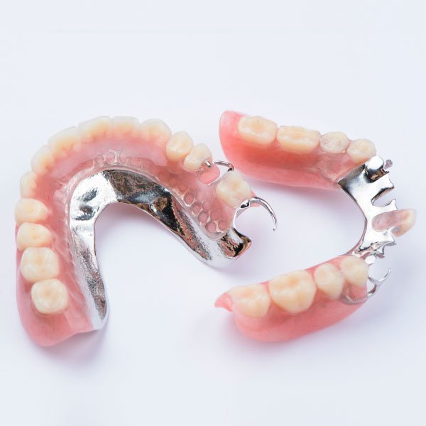 Metal Partial Dentures