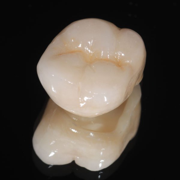 Zirconia Crowns